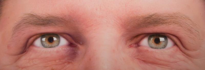 Ojos Ojos